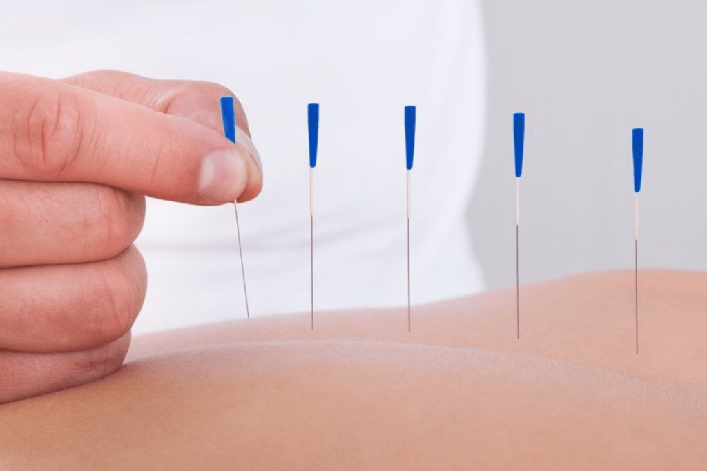 https://clinicafortius.com.br/acupuntura-no-tratamento-na-dor-aguda-e-na-dor-cronica/